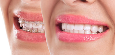 Spectrum Dental | Digital Radiography, ZOOM  Whitening and Dental Bridges