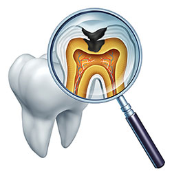 Spectrum Dental | TMJ Disorders, Invisalign reg  and Dental Fillings