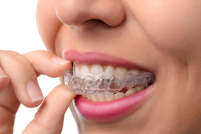 Spectrum Dental | Crowns  amp  Caps, Dental Bridges and TMJ Disorders