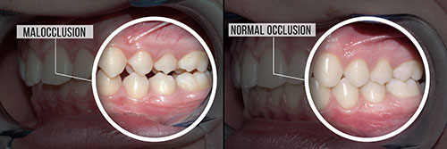 Spectrum Dental | Veneers, Oral Exams and ZOOM  Whitening