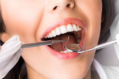 Spectrum Dental | Dental Fillings, Dentures and Veneers