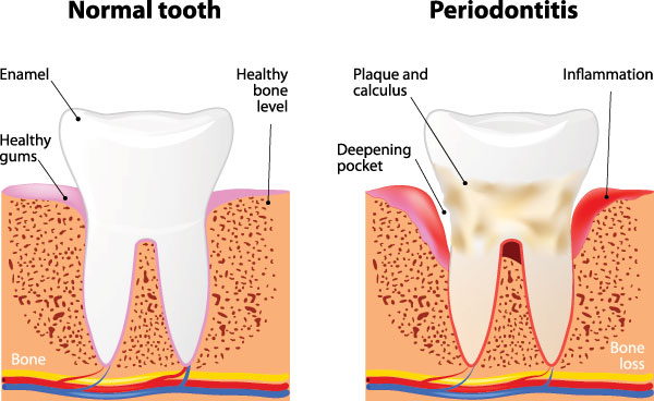 Spectrum Dental | Invisalign reg , Pediatric Dentistry and Crowns  amp  Caps