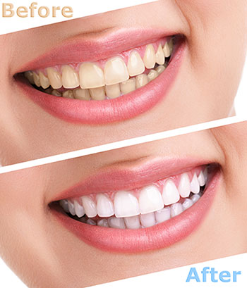 Spectrum Dental | Cosmetic Dentistry, Dental Bridges and Implant Dentistry