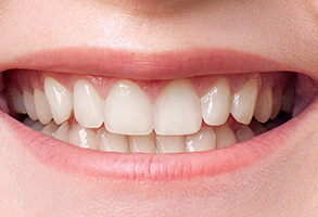 Smiling woman with straight white teeth, showcasing dental hygiene and cosmetic care.