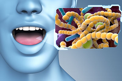 An illustrative graphic showing a human mouth with an open tongue, and on the right side, there s a microscopic image of bacteria or cells.