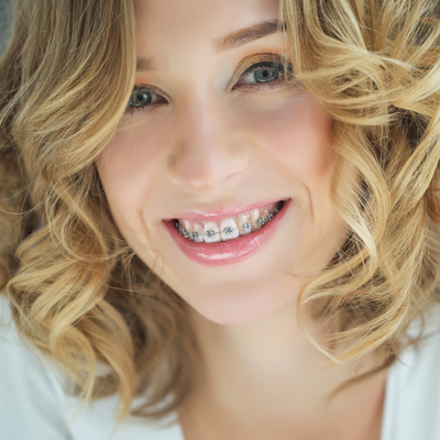 A woman with a bright smile, wearing braces and a white top, against a neutral background.